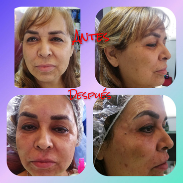 Slider image (3) NES Regenerative Medicine Clinic